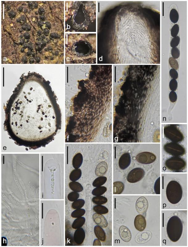 macrostoma