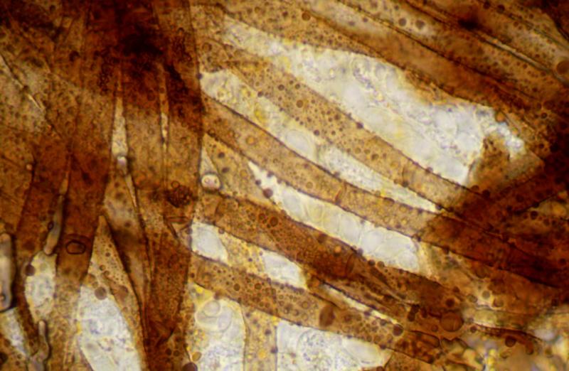 macrostoma