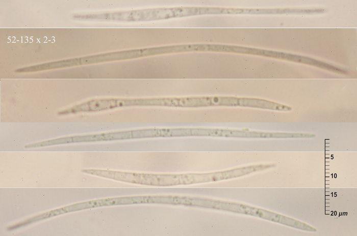 macrostoma