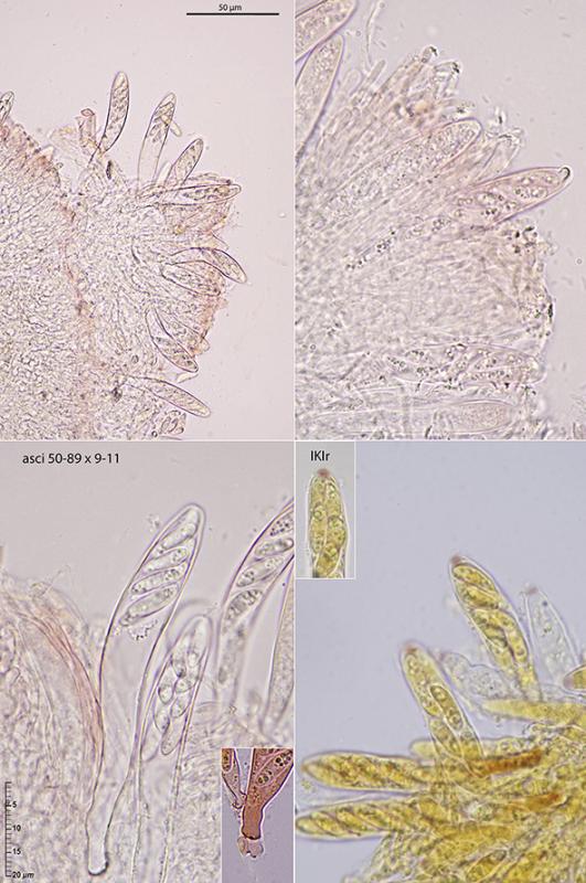 macrostoma