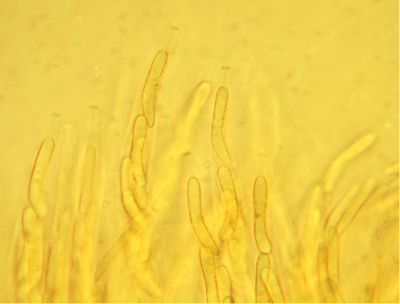 macrostoma
