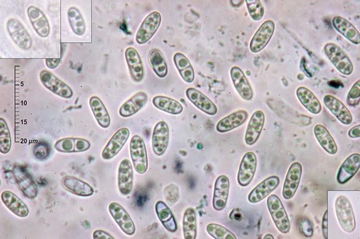 macrostoma