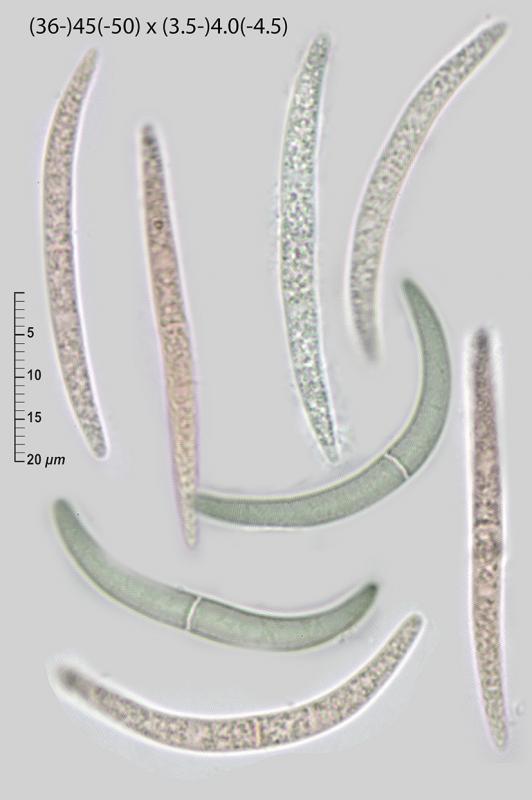macrostoma