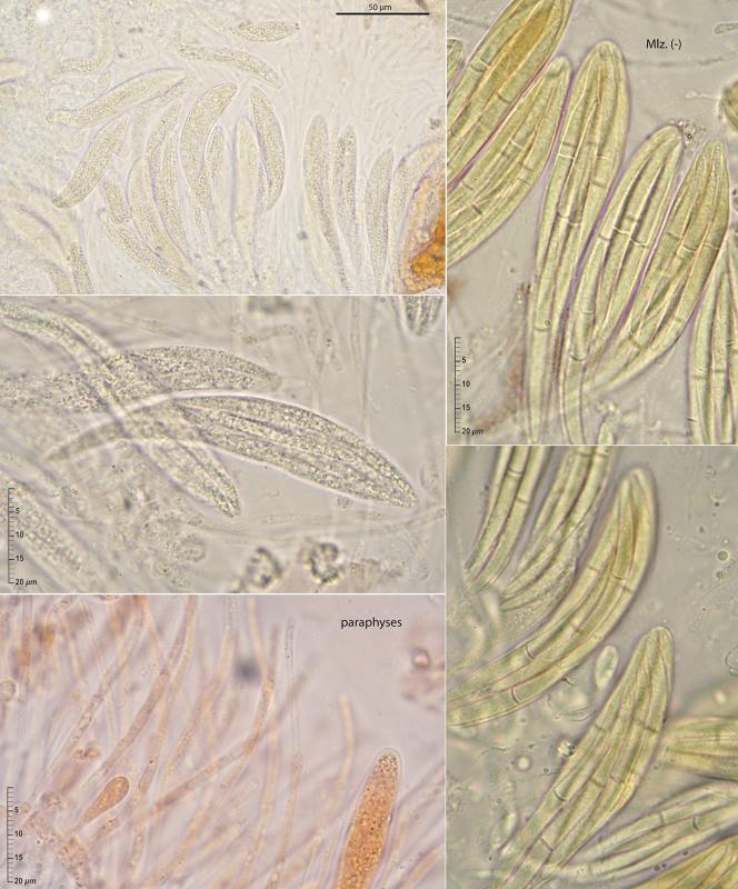 macrostoma