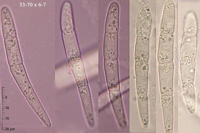 macrostoma