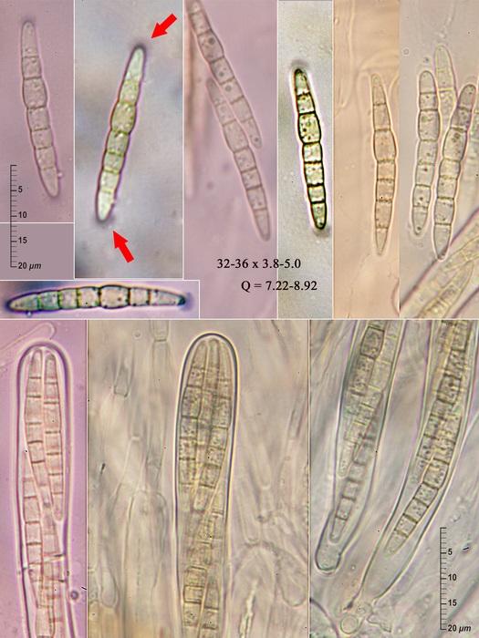 macrostoma