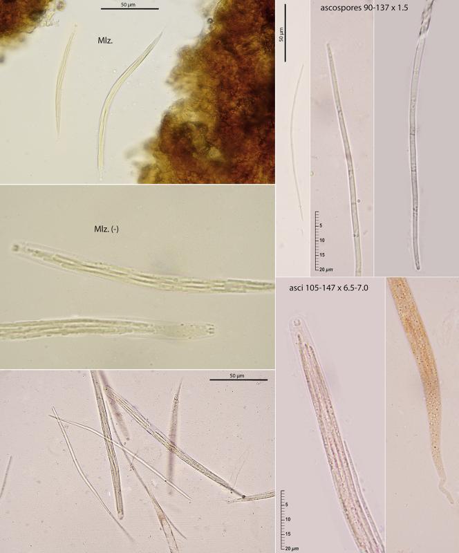 macrostoma