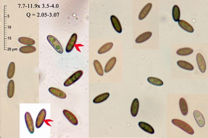 macrostoma