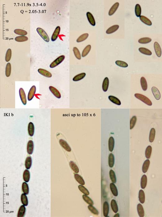 macrostoma