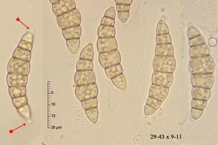 macrostoma