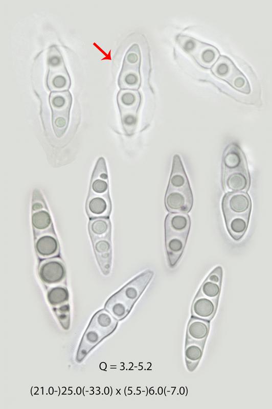 macrostoma