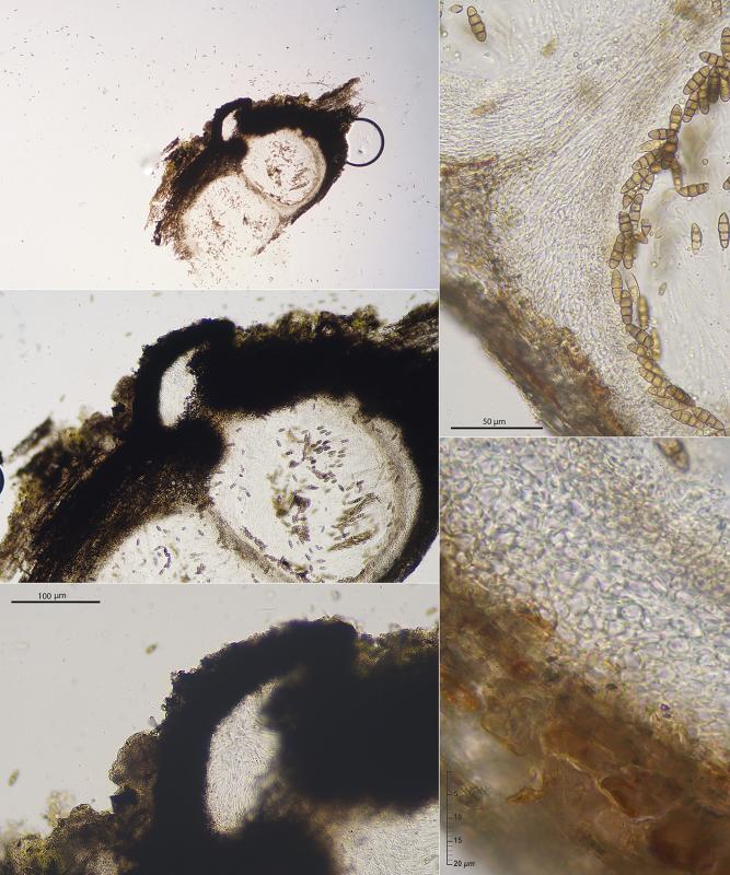 macrostoma