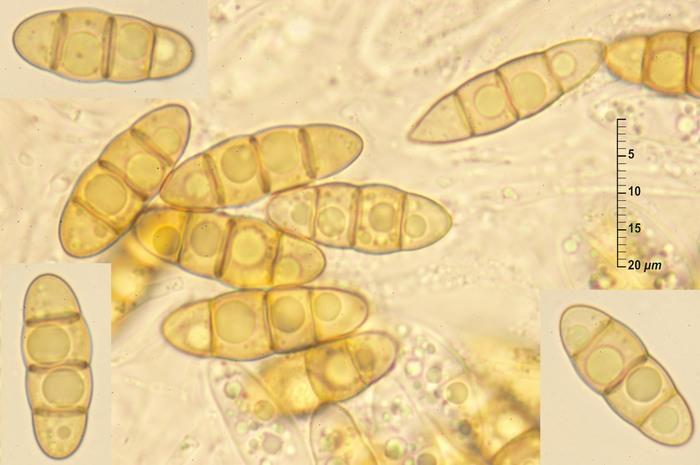 macrostoma