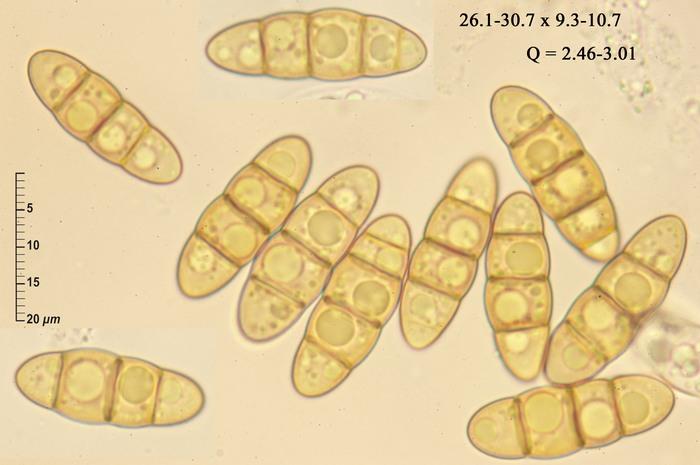 macrostoma
