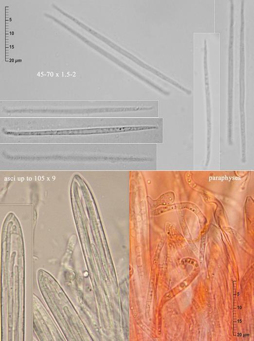 macrostoma