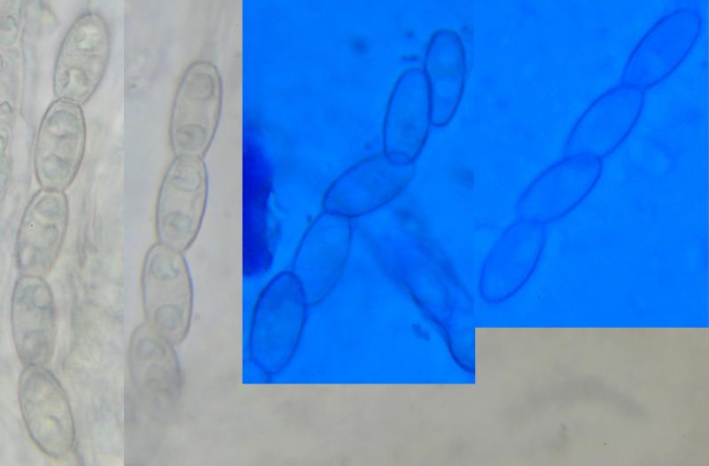 macrostoma