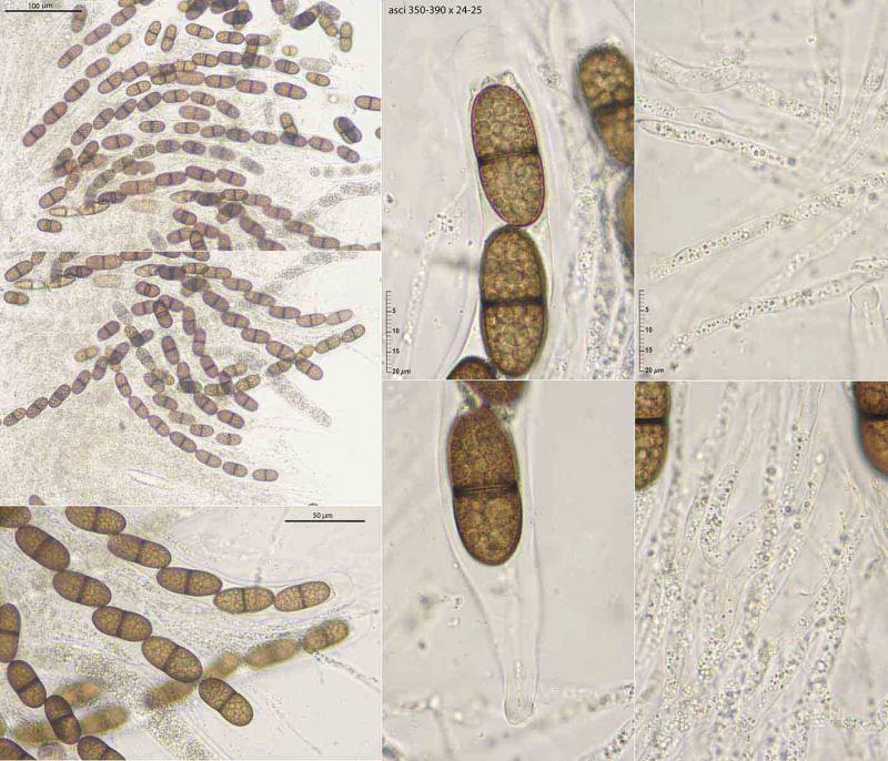 macrostoma