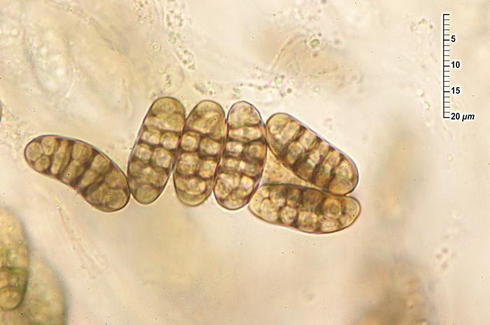 macrostoma