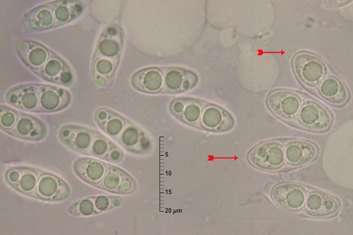 macrostoma