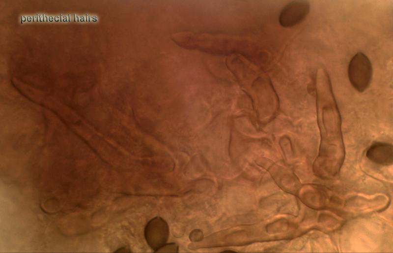 macrostoma