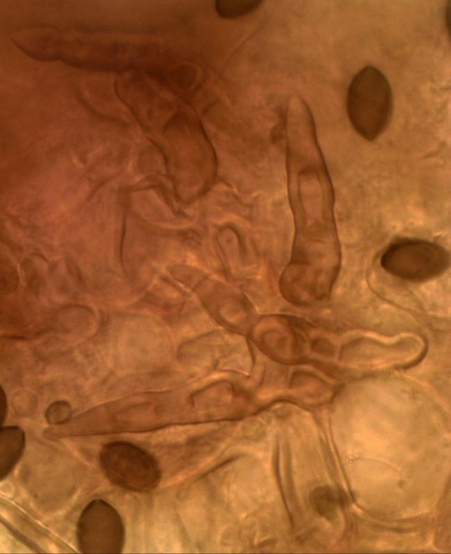 macrostoma