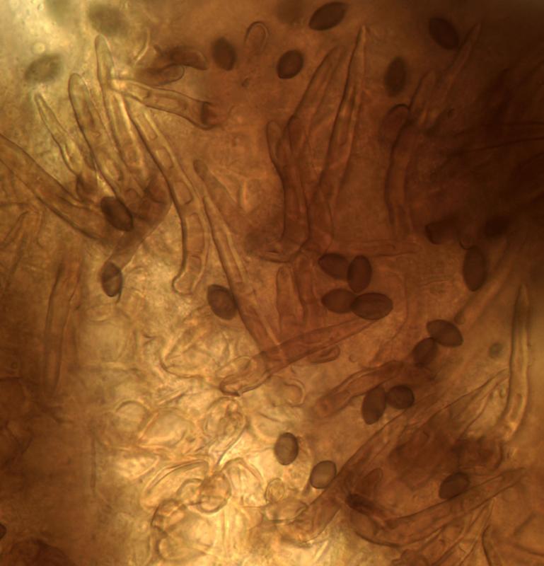 macrostoma