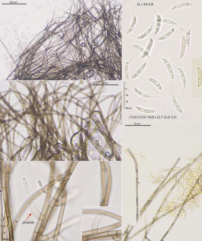 macrostoma