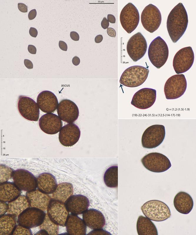 macrostoma