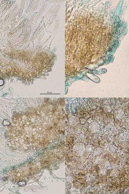 macrostoma