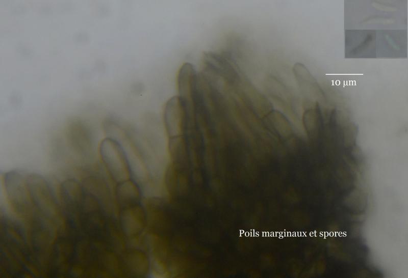 macrostoma