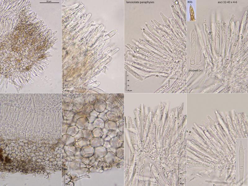 macrostoma
