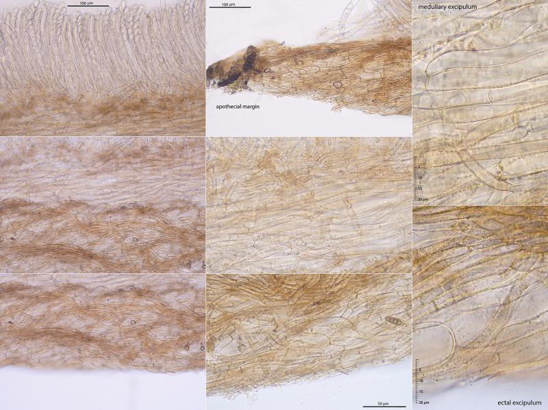 macrostoma