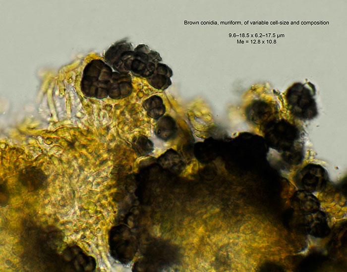 macrostoma