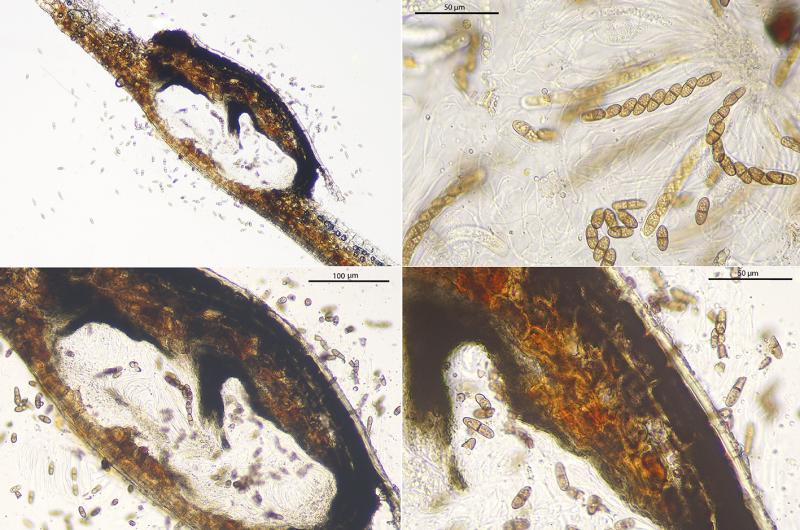 macrostoma