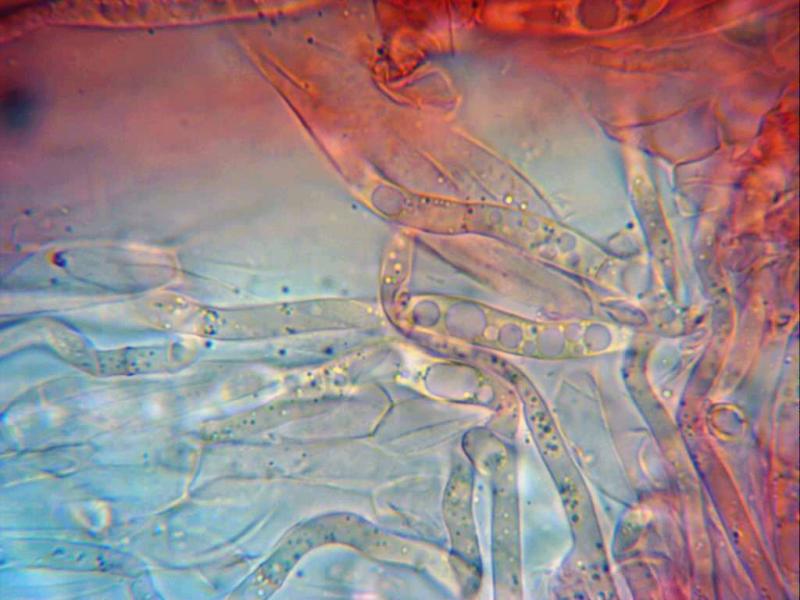 macrostoma