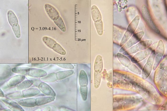 macrostoma