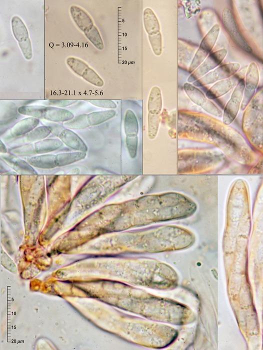macrostoma