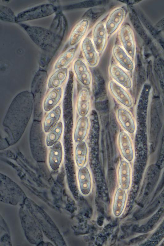 macrostoma