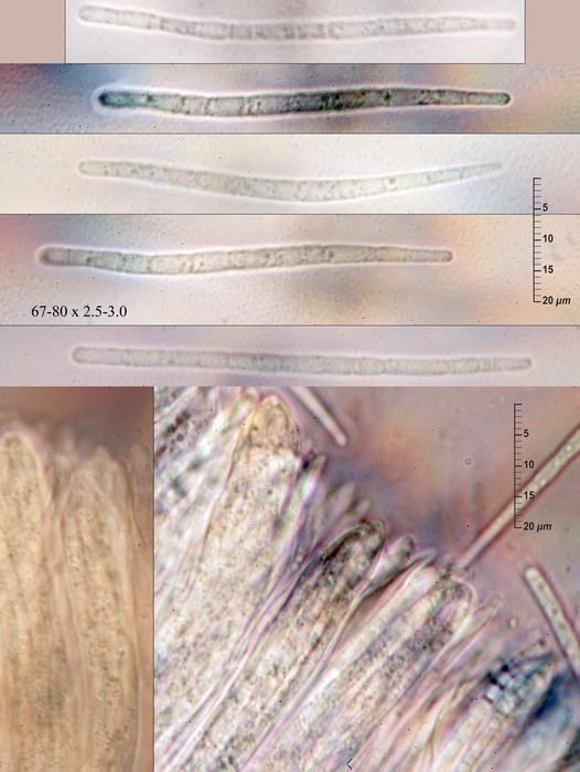 macrostoma