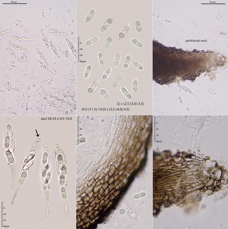 macrostoma