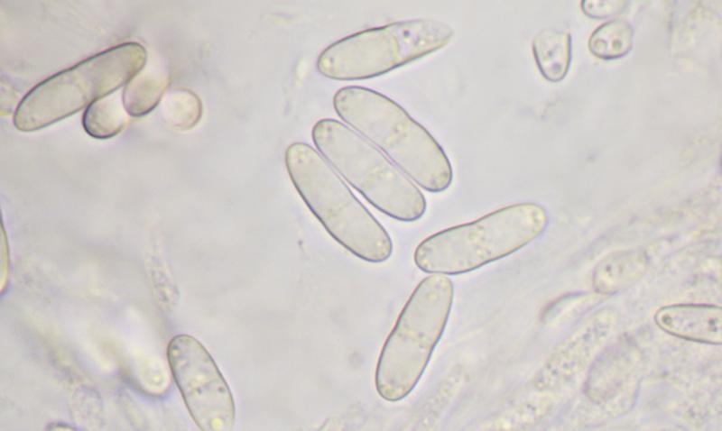 macrostoma