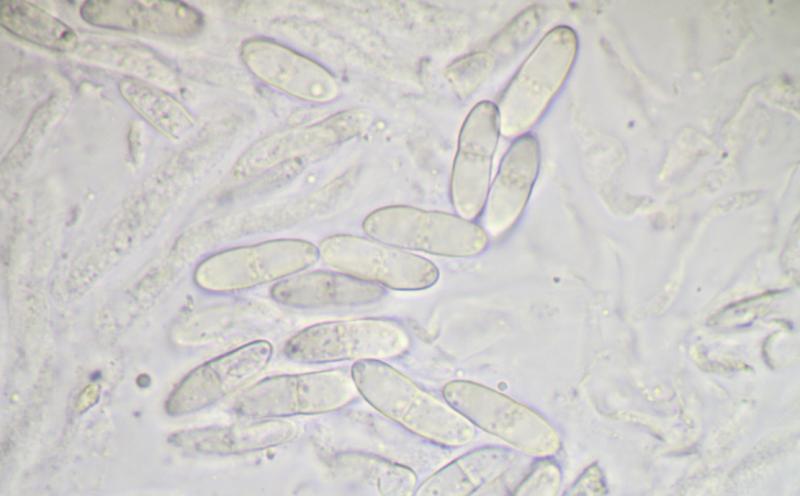 macrostoma