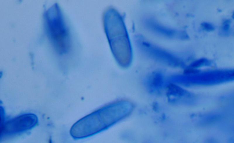 macrostoma