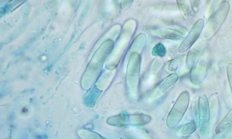 macrostoma