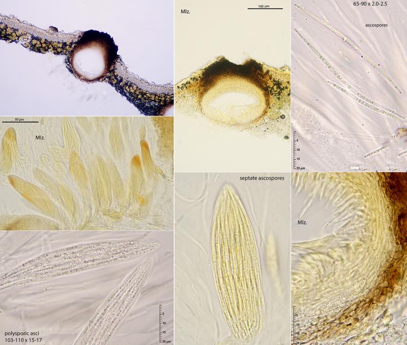 macrostoma