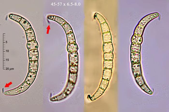 macrostoma