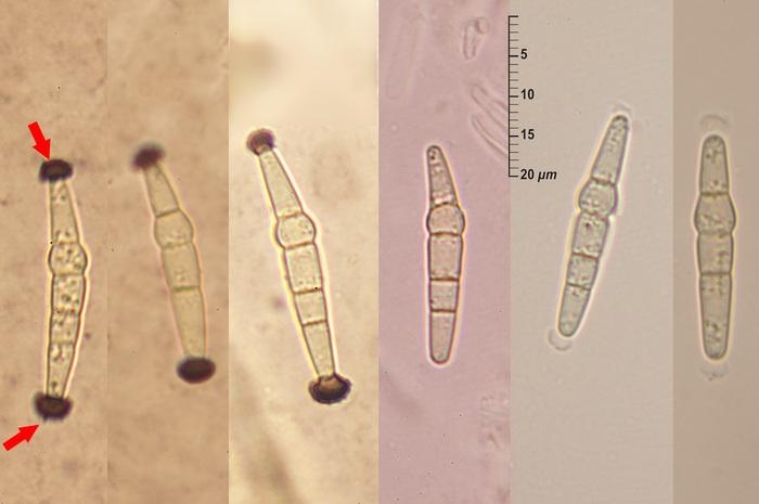 macrostoma