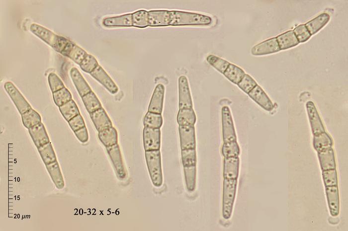 macrostoma