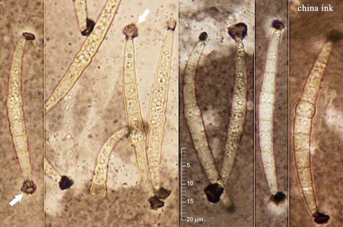 macrostoma
