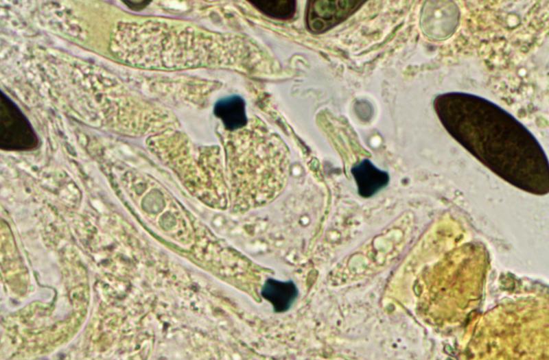 macrostoma